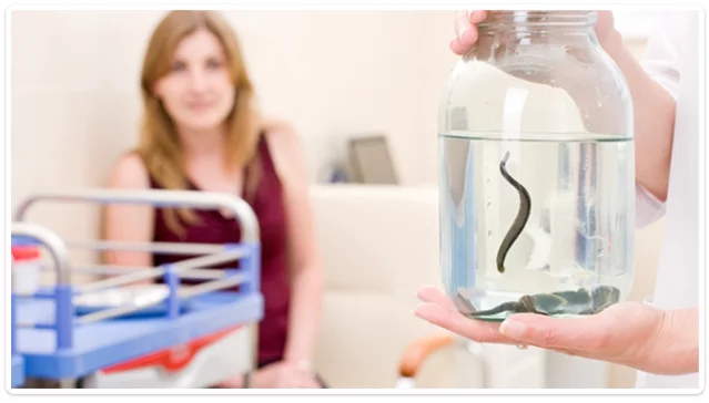 Leech Therapy Centre UK|Fertility