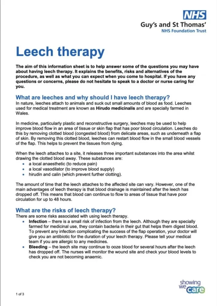 Leech Therapy Centre UK|