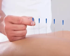 Leech Therapy Centre UK | Acupuncture Leech Therapy Centre UK|Acupuncture