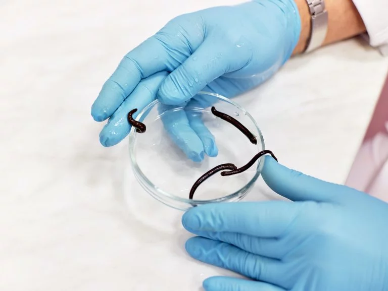 Leech Therapy Centre UK|About Leech Therapy