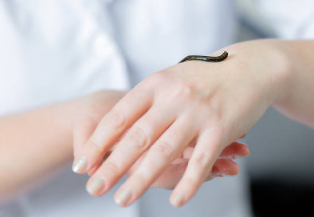 Leech Therapy Centre UK|Fertility