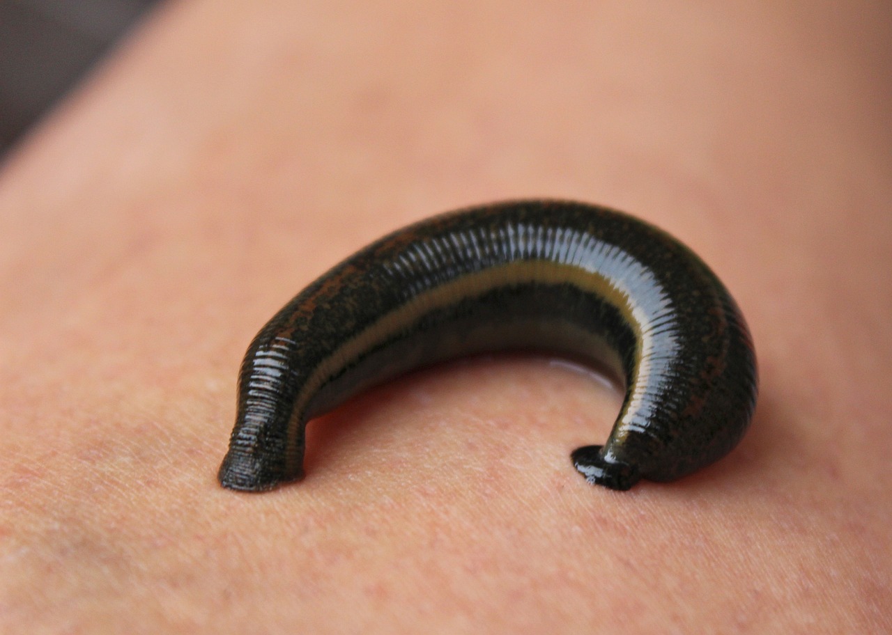 leech, therapy, treatment-1055446.jpg